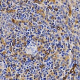 Immunohistochemistry - CDK20 antibody from Signalway Antibody (38440) - Antibodies.com