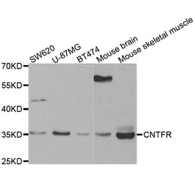 Western blot - CNTFR antibody from Signalway Antibody (38442) - Antibodies.com