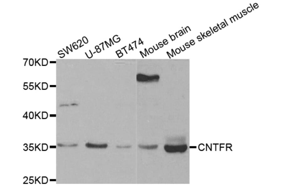 Western blot - CNTFR antibody from Signalway Antibody (38442) - Antibodies.com
