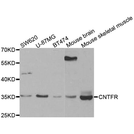 Western blot - CNTFR antibody from Signalway Antibody (38442) - Antibodies.com