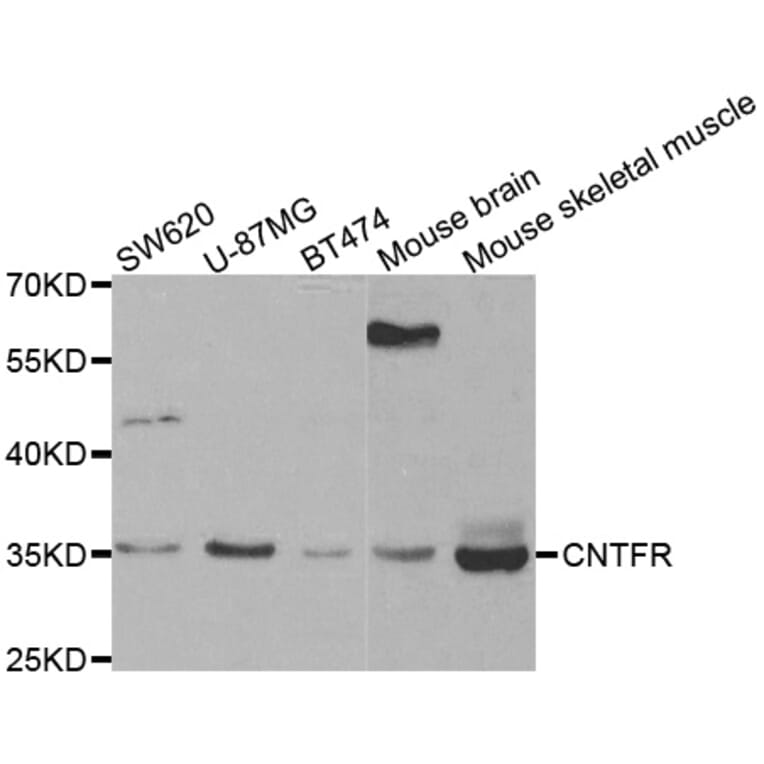 Western blot - CNTFR antibody from Signalway Antibody (38442) - Antibodies.com