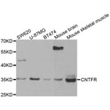 Western blot - CNTFR antibody from Signalway Antibody (38442) - Antibodies.com