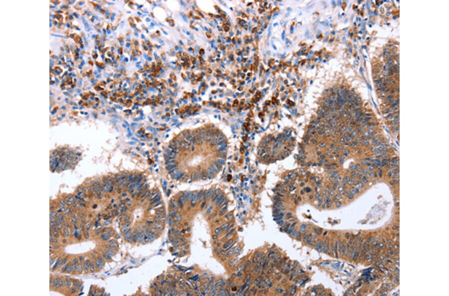 Immunohistochemistry - CNTFR antibody from Signalway Antibody (38442) - Antibodies.com