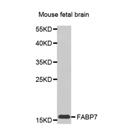 Western blot - FABP7 antibody from Signalway Antibody (38449) - Antibodies.com