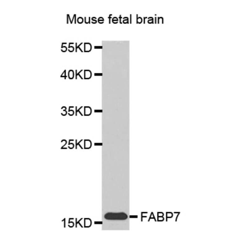 Western blot - FABP7 antibody from Signalway Antibody (38449) - Antibodies.com