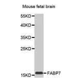 Western blot - FABP7 antibody from Signalway Antibody (38449) - Antibodies.com