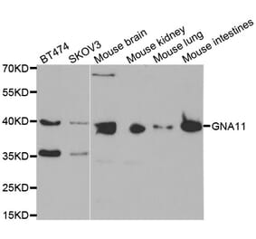 Western blot - GNA11 antibody from Signalway Antibody (38451) - Antibodies.com