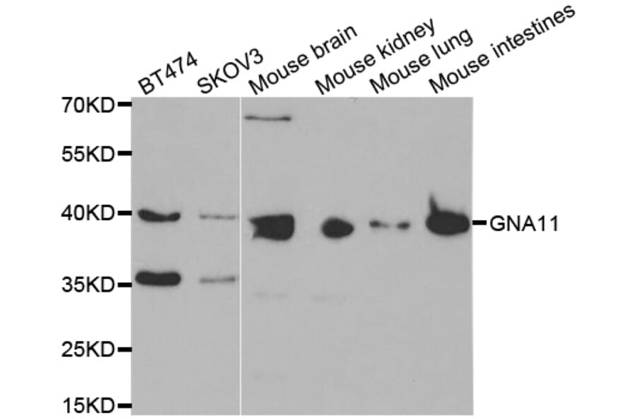 Western blot - GNA11 antibody from Signalway Antibody (38451) - Antibodies.com