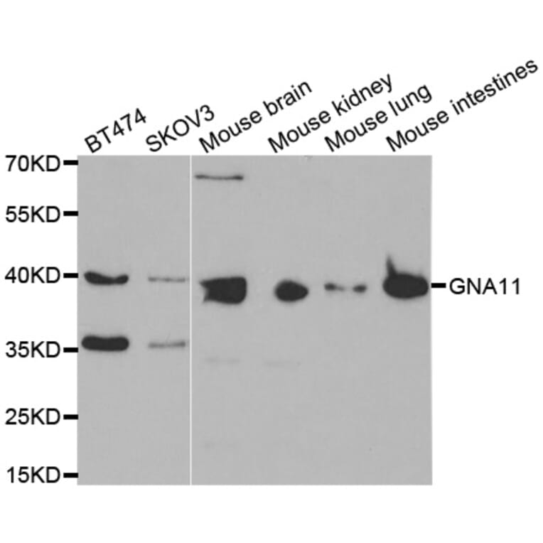 Western blot - GNA11 antibody from Signalway Antibody (38451) - Antibodies.com