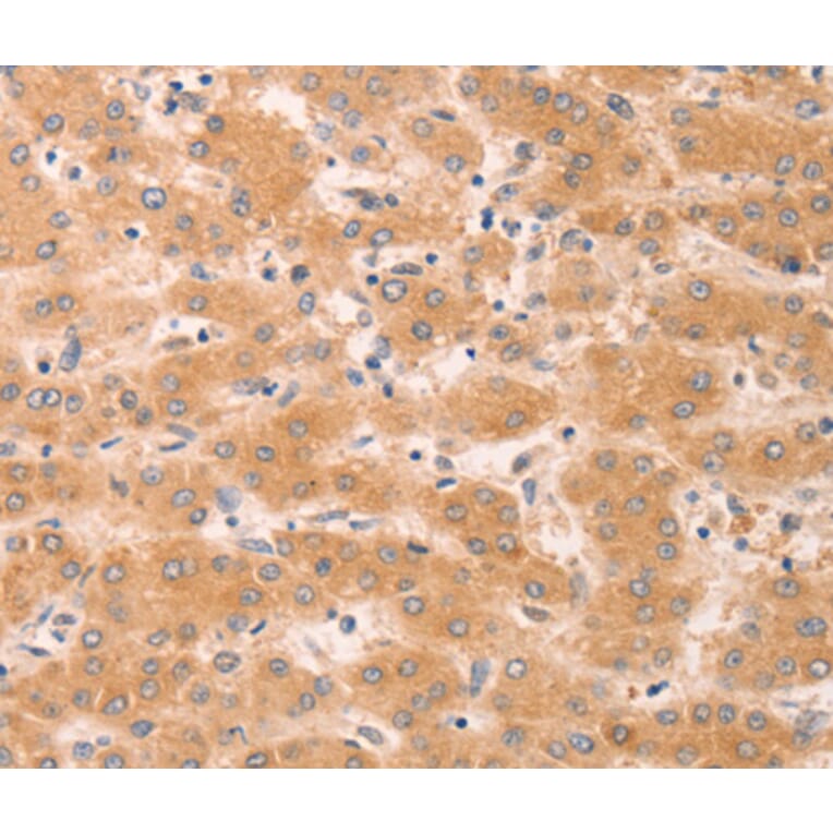 Immunohistochemistry - GNA11 antibody from Signalway Antibody (38451) - Antibodies.com