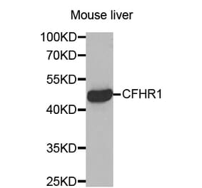 Western blot - CFHR1 antibody from Signalway Antibody (38454) - Antibodies.com