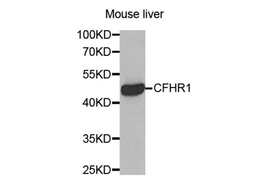 Western blot - CFHR1 antibody from Signalway Antibody (38454) - Antibodies.com