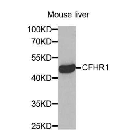 Western blot - CFHR1 antibody from Signalway Antibody (38454) - Antibodies.com