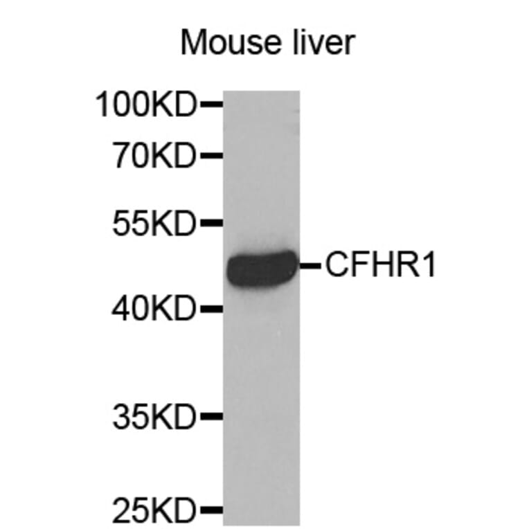 Western blot - CFHR1 antibody from Signalway Antibody (38454) - Antibodies.com