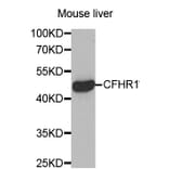 Western blot - CFHR1 antibody from Signalway Antibody (38454) - Antibodies.com