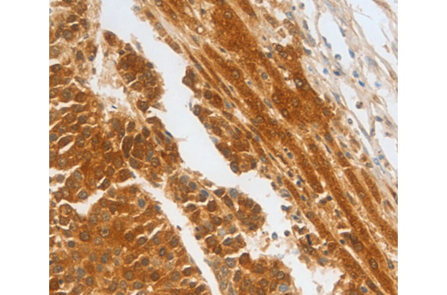 Immunohistochemistry - CFHR1 antibody from Signalway Antibody (38454) - Antibodies.com