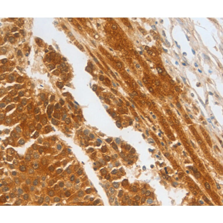 Immunohistochemistry - CFHR1 antibody from Signalway Antibody (38454) - Antibodies.com