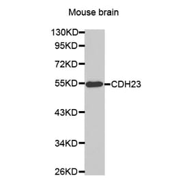 Western blot - CDH23 antibody from Signalway Antibody (38463) - Antibodies.com