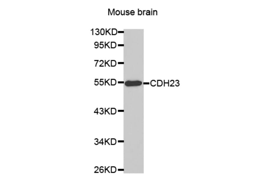 Western blot - CDH23 antibody from Signalway Antibody (38463) - Antibodies.com