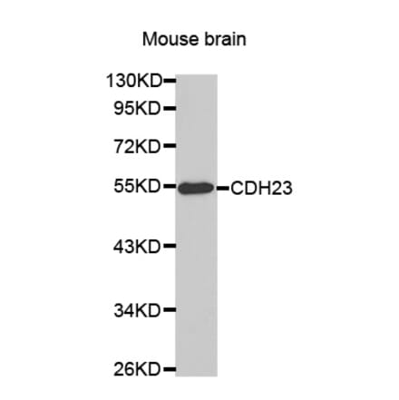 Western blot - CDH23 antibody from Signalway Antibody (38463) - Antibodies.com