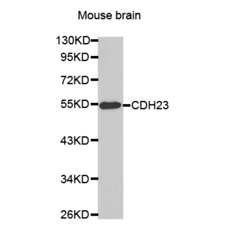 Western blot - CDH23 antibody from Signalway Antibody (38463) - Antibodies.com