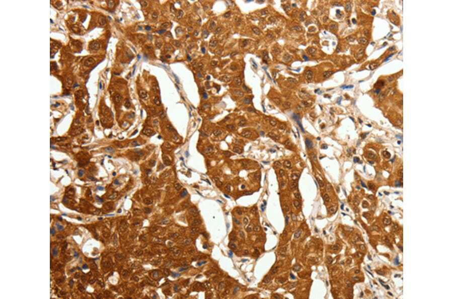 Immunohistochemistry - CDH23 antibody from Signalway Antibody (38463) - Antibodies.com