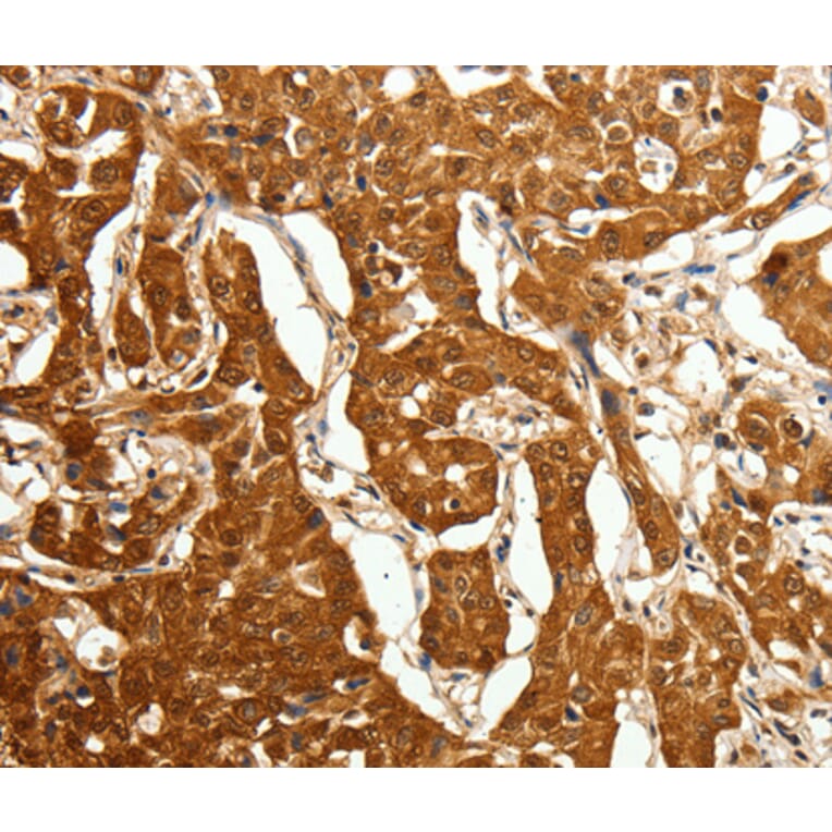 Immunohistochemistry - CDH23 antibody from Signalway Antibody (38463) - Antibodies.com