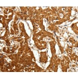 Immunohistochemistry - CDH23 antibody from Signalway Antibody (38463) - Antibodies.com