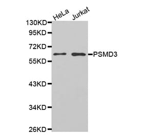 Western blot - PSMD3 antibody from Signalway Antibody (38466) - Antibodies.com