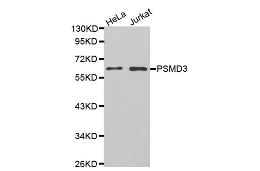 Western blot - PSMD3 antibody from Signalway Antibody (38466) - Antibodies.com