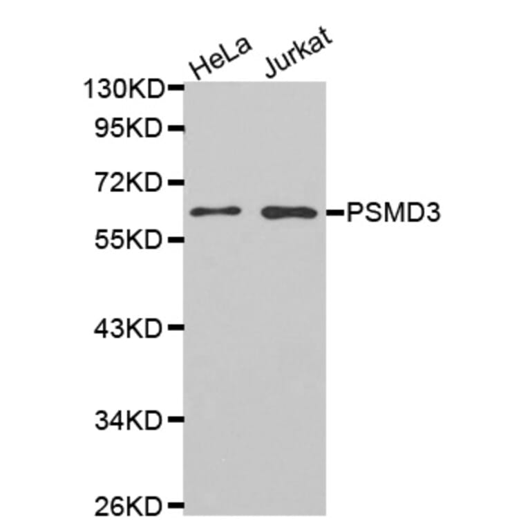 Western blot - PSMD3 antibody from Signalway Antibody (38466) - Antibodies.com