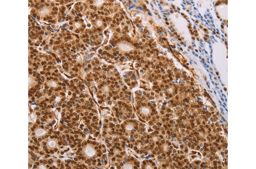 Immunohistochemistry - PSMD3 antibody from Signalway Antibody (38466) - Antibodies.com