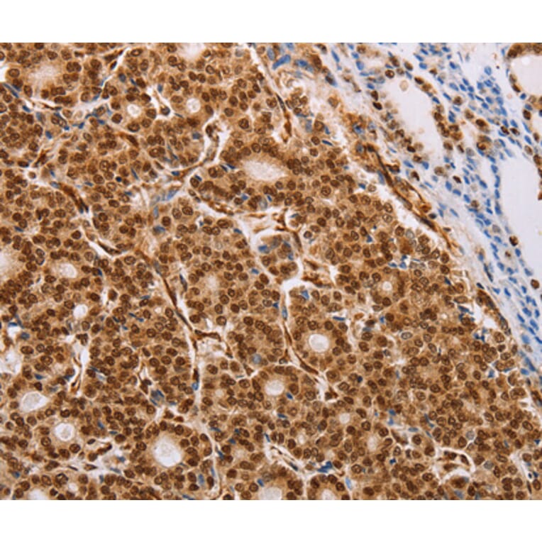 Immunohistochemistry - PSMD3 antibody from Signalway Antibody (38466) - Antibodies.com