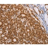 Immunohistochemistry - PSMD3 antibody from Signalway Antibody (38466) - Antibodies.com