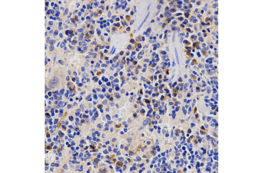 Immunohistochemistry - PSMD3 antibody from Signalway Antibody (38466) - Antibodies.com