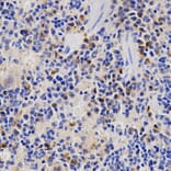 Immunohistochemistry - PSMD3 antibody from Signalway Antibody (38466) - Antibodies.com