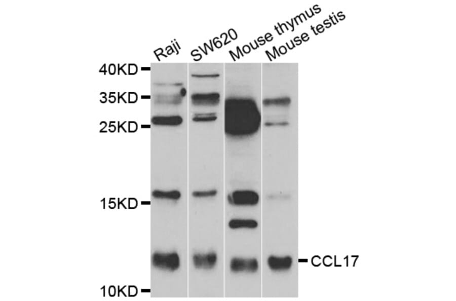 Western blot - CCL17 antibody from Signalway Antibody (38473) - Antibodies.com
