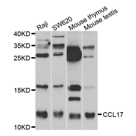 Western blot - CCL17 antibody from Signalway Antibody (38473) - Antibodies.com