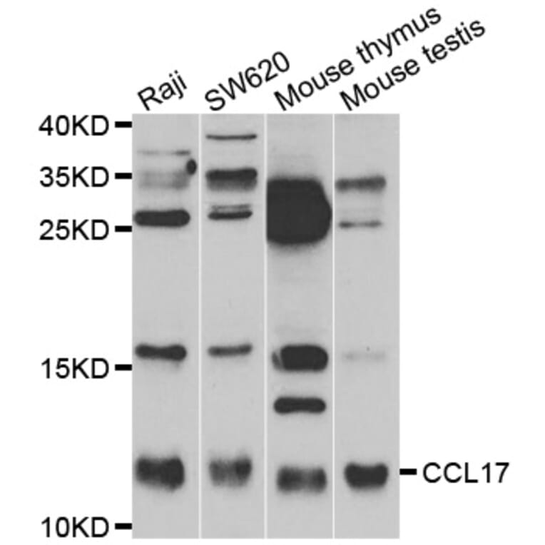 Western blot - CCL17 antibody from Signalway Antibody (38473) - Antibodies.com