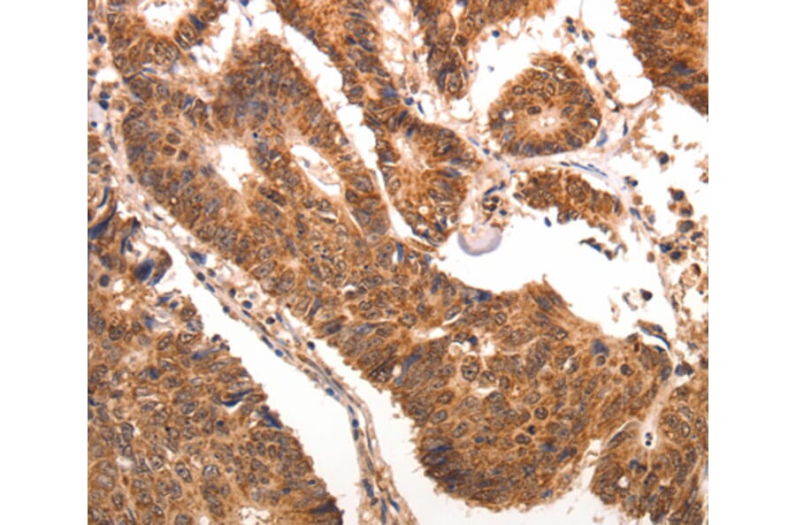 Immunohistochemistry - CCL17 antibody from Signalway Antibody (38473) - Antibodies.com