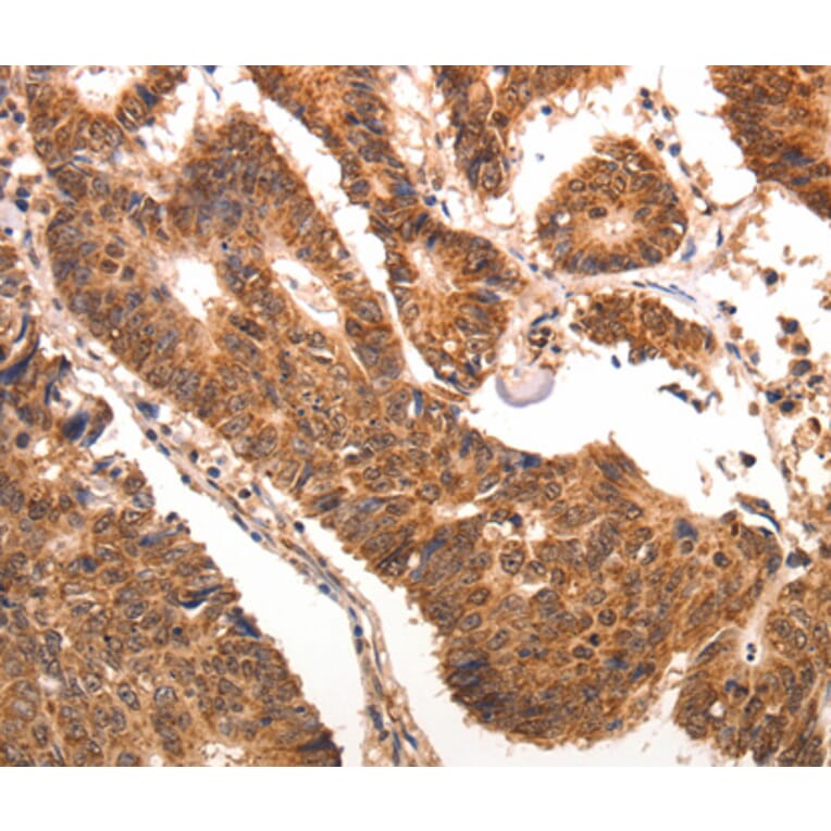Immunohistochemistry - CCL17 antibody from Signalway Antibody (38473) - Antibodies.com