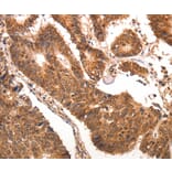 Immunohistochemistry - CCL17 antibody from Signalway Antibody (38473) - Antibodies.com