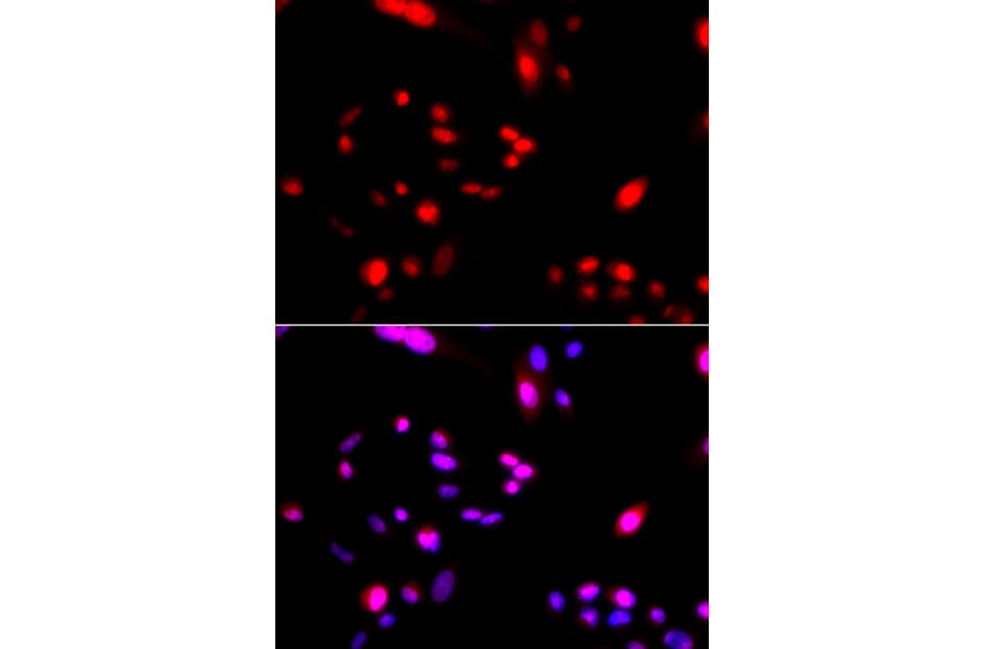 Immunofluorescence - CUL4A antibody from Signalway Antibody (38477) - Antibodies.com