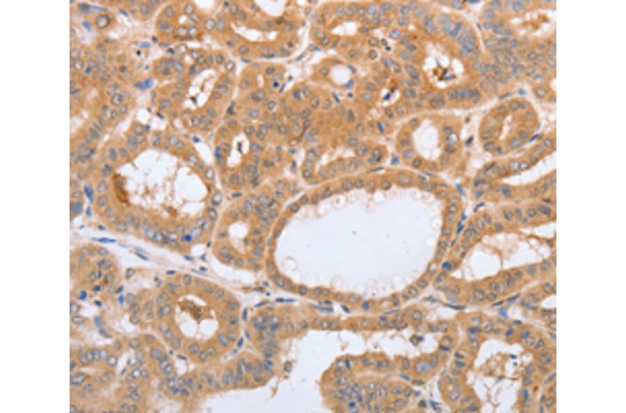 Immunohistochemistry - LAMP3 antibody from Signalway Antibody (38484) - Antibodies.com