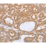 Immunohistochemistry - LAMP3 antibody from Signalway Antibody (38484) - Antibodies.com