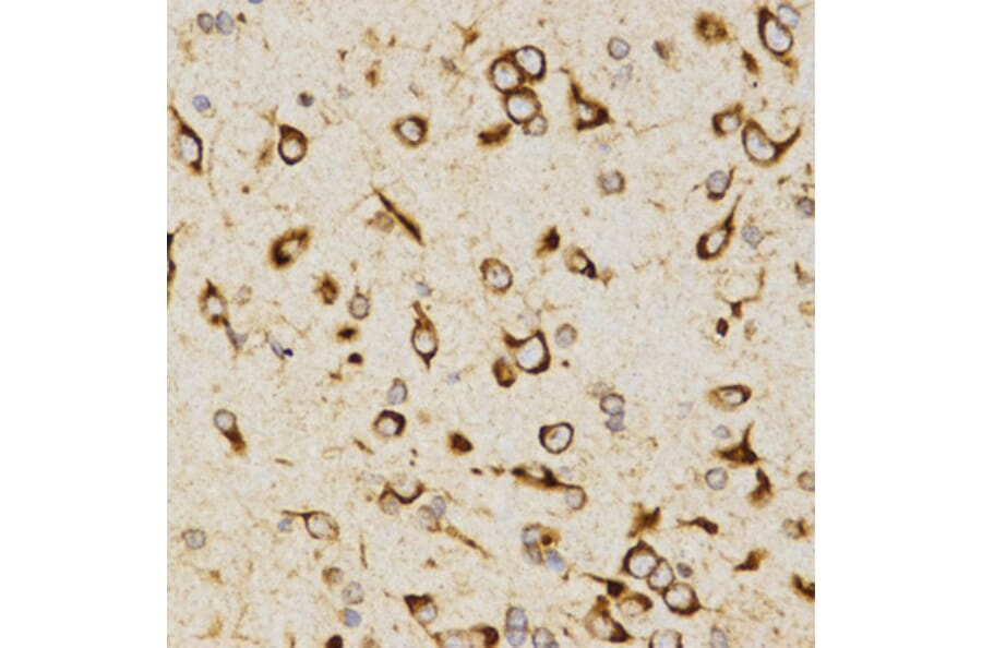 Immunohistochemistry - LAMP3 antibody from Signalway Antibody (38484) - Antibodies.com