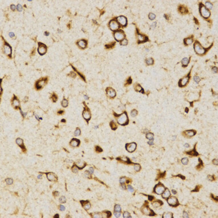 Immunohistochemistry - LAMP3 antibody from Signalway Antibody (38484) - Antibodies.com