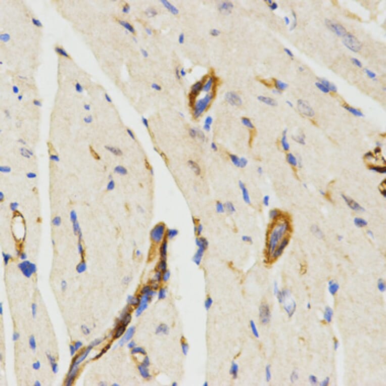 Immunohistochemistry - LAMP3 antibody from Signalway Antibody (38484) - Antibodies.com