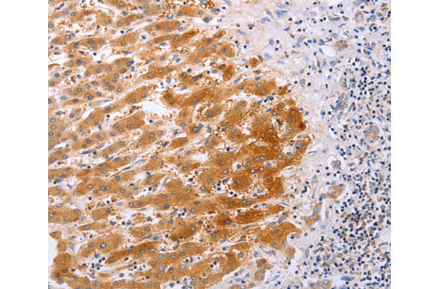 Immunohistochemistry - DISC1 antibody from Signalway Antibody (38487) - Antibodies.com