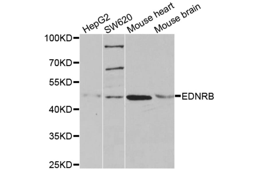 Western blot - EDNRB antibody from Signalway Antibody (38492) - Antibodies.com